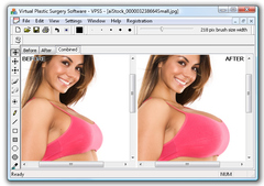 Imagen Virtual Plastic Surgery Software 1.0