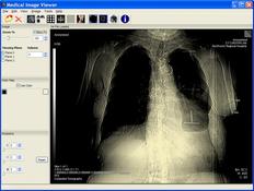 Image MiView 0.6.254